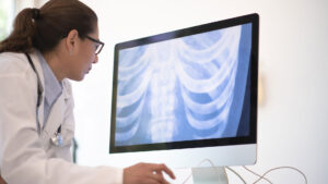 causes of lung cancer