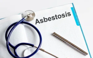How Long Does it Take Asbestosis to Develop