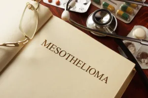Is Mesothelioma Curable