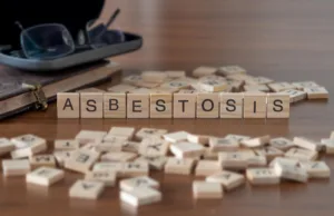 Is asbestosis treatable