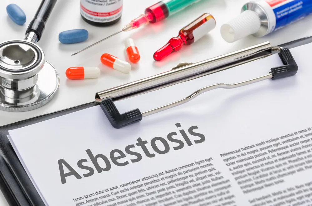 Treatment of Asbestosis