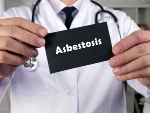 What are the Symptoms of Asbestosis
