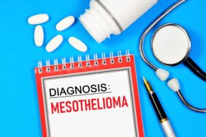 Mesothelioma is a tumor of mesothelial cells. Doctor's diagnosis label. Medication treatment required.