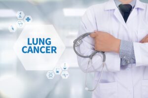 LUNG CANCER: A medical doctor using a computer interface for diagnosis and treatment planning.