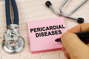 Medical concept: A stethoscope and a sticker with the inscription "pericardial diseases" are placed on cardiograms.