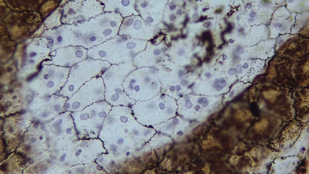 The simple squamous epithelium, or mesothelium, is the tissue that lines the pleura, peritoneum, and pericardium.