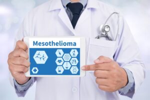 Mesothelioma treatment options for managing mesothelioma cancer, including surgery, chemotherapy, and radiation therapy