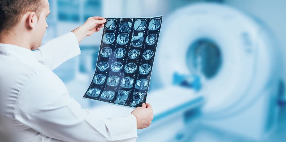 A doctor examining an MRI image with medical equipment in the background.