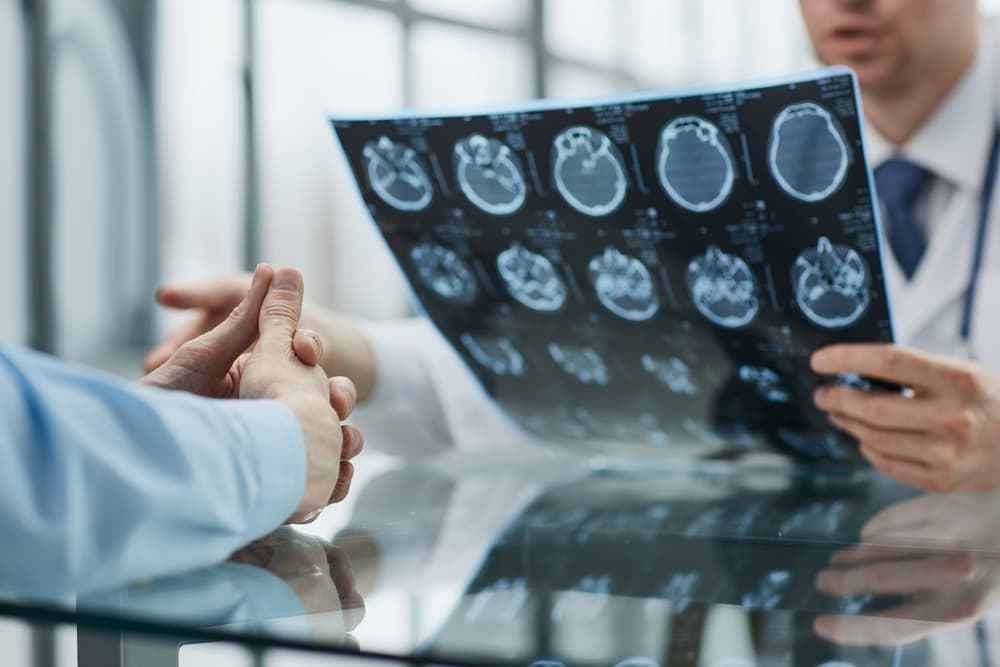 Doctor examining patient's x-ray to diagnose the cancer causes by asbestos