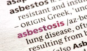 Asbestosis is a chronic lung disease caused by inhaling asbestos fibers