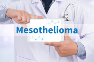 Why You Need an Experienced Mesothelioma Lawyer Navigating Your Complex Lawsuit